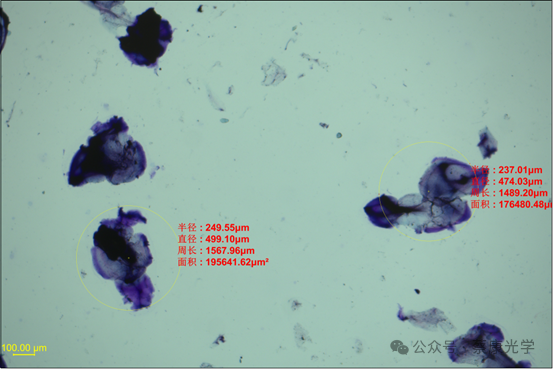交聯(lián)透明質(zhì)酸鈉凝膠顆粒剖析內(nèi)在價(jià)值的顯微分析方案 