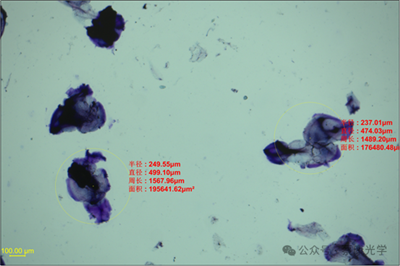 交聯(lián)透明質(zhì)酸鈉凝膠顆粒剖析內(nèi)在價(jià)值的顯微分析方案 